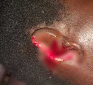 Man ‘chews’ off wife's ear in scuffle at Dambai