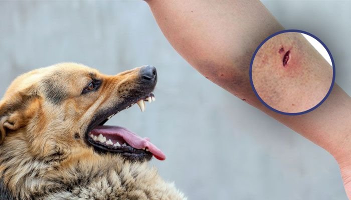 Rabies kills 5 persons in Western and Western North regions